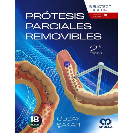 PROTESIS PARCIALES REMOVIBLES