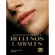 ARMONIZACION OROFACIAL: RELLENOS LABIALES