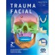 TRAUMA FACIAL