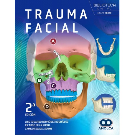 TRAUMA FACIAL