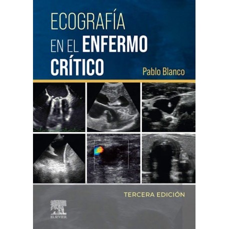 ECOGRAFIA EN EL ENFERMO CRITICO