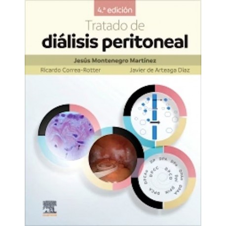 TRATADO DE DIALISIS PERITONEAL