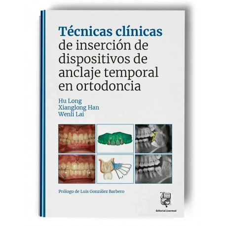 TECNICAS CLINICAS DE INSERCION DE DISPOSITIVOS DE ANCLAJE TEMPORAL EN ORTODONCIA