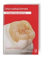 INCRUSTACIONES. MANUAL CLINICO