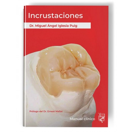 INCRUSTACIONES. MANUAL CLINICO
