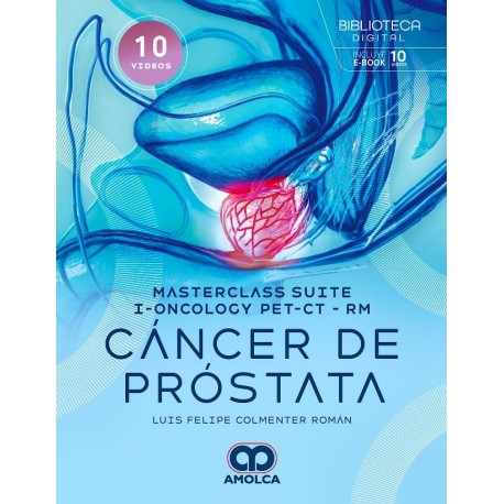 MASTERCLASS SUITE-I-ONCOLOGY PET/CT-RM. CANCER DE PROSTATA