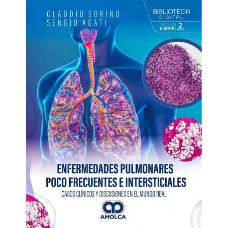 ENFERMEDADES PULMONARES POCO FRECUENTES E INTERSTICIALES