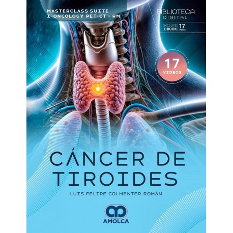 MASTERCLASS SUITE-I-ONCOLOGY PET/CT-RM. CANCER DE TIROIDES