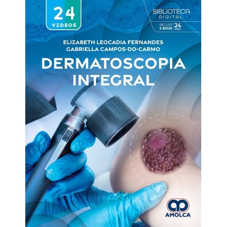 DERMATOSCOPIA INTEGRAL