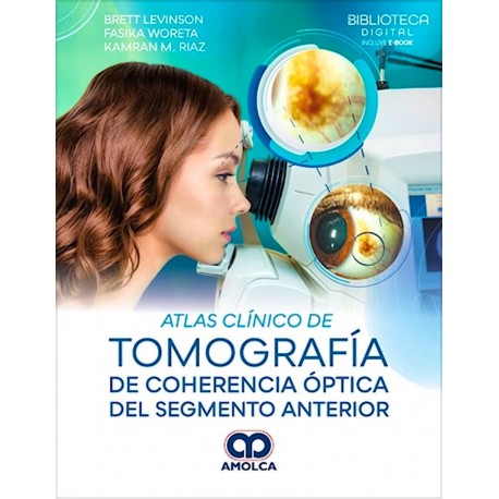 ATLAS CLINICO DE TOMOGRAFIA DE COHERENCIA OPTICA DEL SEGMENTO ANTERIOR