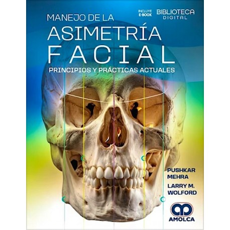 MANEJO DE LA ASIMETRIA FACIAL. PRINCIPIOS Y PRACTICAS ACTUALES