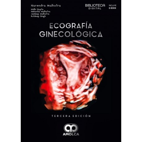 ECOGRAFIA EN GINECOLOGIA