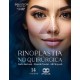 RINOPLASTIA NO QUIRURGICA