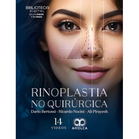 RINOPLASTIA NO QUIRURGICA
