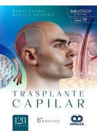 TRASPLANTE CAPILAR (INCLUYE E-BOOK 120 VIDEOS)