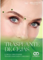 TRASPLANTE DE CEJAS