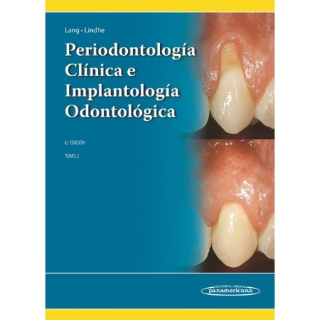 PERIODONTOLOGIA CLINICA E IMPLANTOLOGIA ODONTOLOGICA (VOL.2)