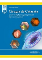 CIRUGIA DE CATARATA. CASOS COMPLEJOS Y GUIA PRACTICA PARA SU RESOLUCION
