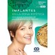 IMPLANTES EN LA ZONA ESTETICA. GUIA PARA EL TRATAMIENTO DEL PACIENTE PARCIALMENTE EDENTULO
