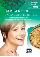IMPLANTES EN LA ZONA ESTETICA. GUIA PARA EL TRATAMIENTO DEL PACIENTE PARCIALMENTE EDENTULO
