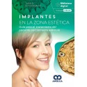 IMPLANTES EN LA ZONA ESTETICA. GUIA PARA EL TRATAMIENTO DEL PACIENTE PARCIALMENTE EDENTULO