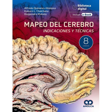 MAPEO DEL CEREBRO. INDICACIONES Y TECNICAS