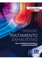 TRATAMIENTO EXHAUSTIVO DE LA ARTROSIS DE RODILLA. AVANCES RECIENTES