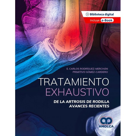 TRATAMIENTO EXHAUSTIVO DE LA ARTROSIS DE RODILLA. AVANCES RECIENTES