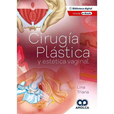 CIRUGIA PLASTICA Y ESTETICA VAGINAL