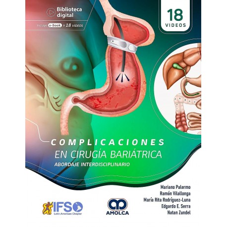 COMPLICACIONES EN CIRUGIA BARIATRICA. ABORDAJE INTERDISCIPLINARIO