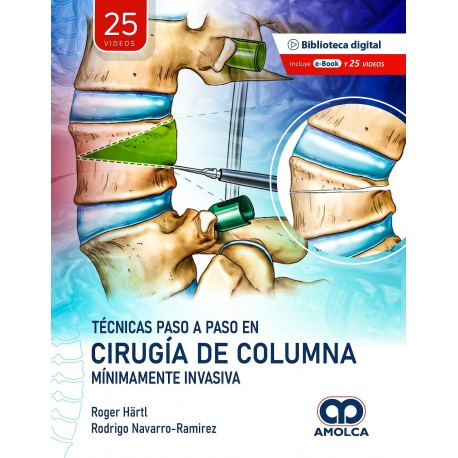TECNICAS PASO A ASO EN CIRUGIA DE COLUMNA MINIMAMENTE INVASIVA