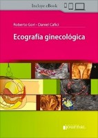 ECOGRAFIA GINECOLOGICA