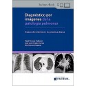 DIAGNOSTICO POR IMAGENES DE LA PATOLOGIA PULMONAR.CASOS DE INTERES EN LA PRACTICA DIARIA
