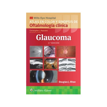 WILLS EYE HOSPITAL. ATLAS EN COLOR Y SINOPSIS DE OFTALMOLOGIA CLINICA. GLAUCOMA