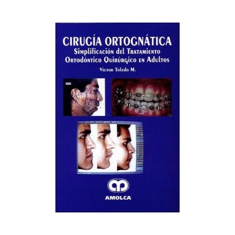 CIRUGIA ORTOGNATICA
