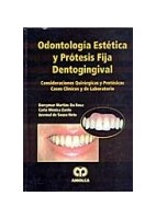 ODONTOLOGIA ESTETICA Y PROTESIS FIJA DENTOGINGIVAL
