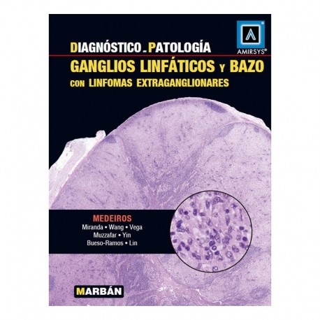 DIAGNOSTICO EN PATOLOGIA. GANGLIOS LINFATICOS Y BAZO CON LINFOMAS EXTRAGANGLIONARES