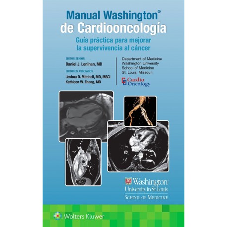MANUAL WASHINGTON DE CARDIOONCOLOGIA. GUIA PRACTICA PARA MEJORAR LA SUPERVIVENCIA DEL CANCER