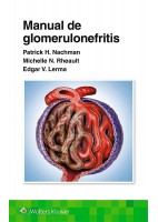 MANUAL DE GLOMERULONEFRITIS