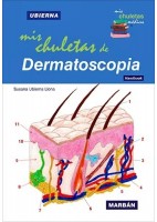 MIS CHULETAS DE DERMATOSCOPIA