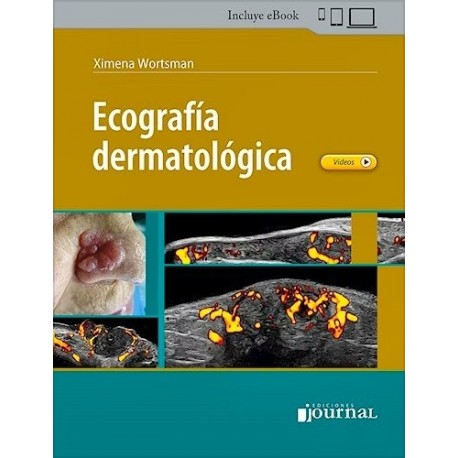 ECOGRAFIA DERMATOLOGICA