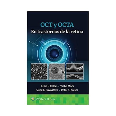 OCT Y OCTA EN TRASTONRNOS DE LA RETINA