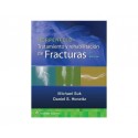 HOPPENFIELD. TRATAMIENTO Y REHABILITACION DE FRACTURAS