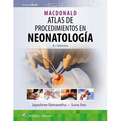 MACDONALD. ATLAS DE PROCEDIMIENTOS EN NEONATOLOGIA (INCLUYE EBOOK)