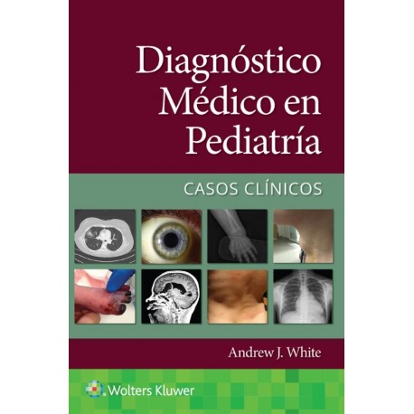 DIAGNOSTICO MEDICO EN PEDIATRIA. CASOS CLINICOS