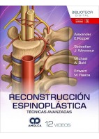 RECONSTRUCCION ESPINOPLASTICA. TECNICAS AVANZADAS