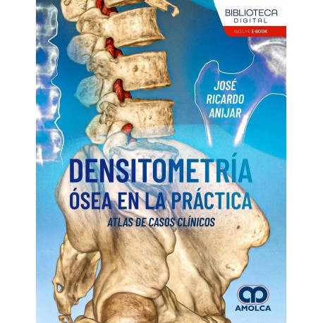 DENSITOMETRIA OSEA EN LA PRACTICA. ATLAS DE CASOS CLINICOS
