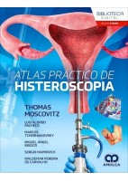 ATLAS PRACTICO DE HISTEROSCOPIA
