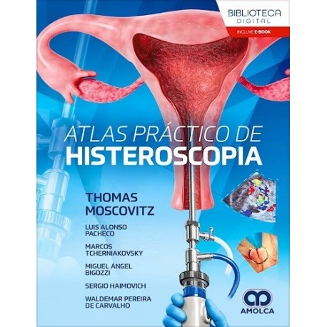 ATLAS PRACTICO DE HISTEROSCOPIA