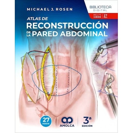 ATLAS DE RECONSTRUCCION DE LA PARED ABDOMINAL